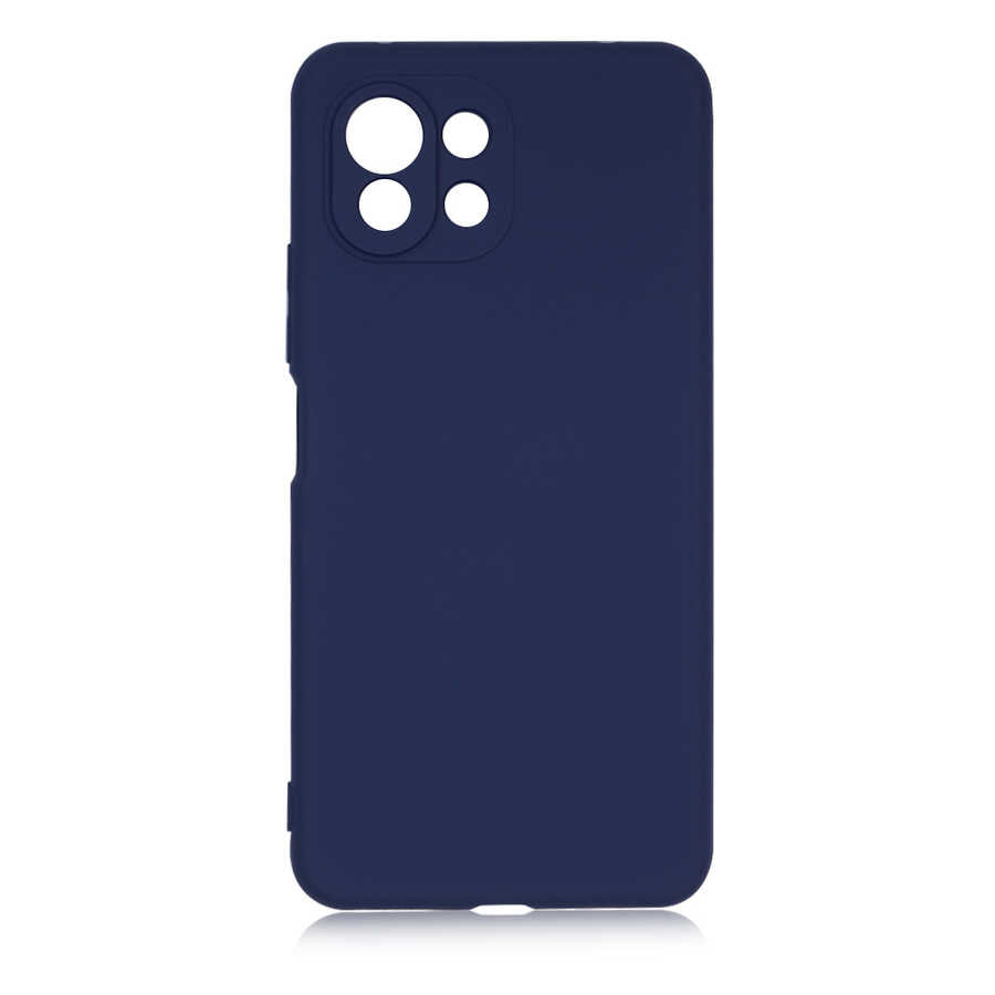 Xiaomi Mi 11 Lite Kılıf Zore Mara Lansman Kapak